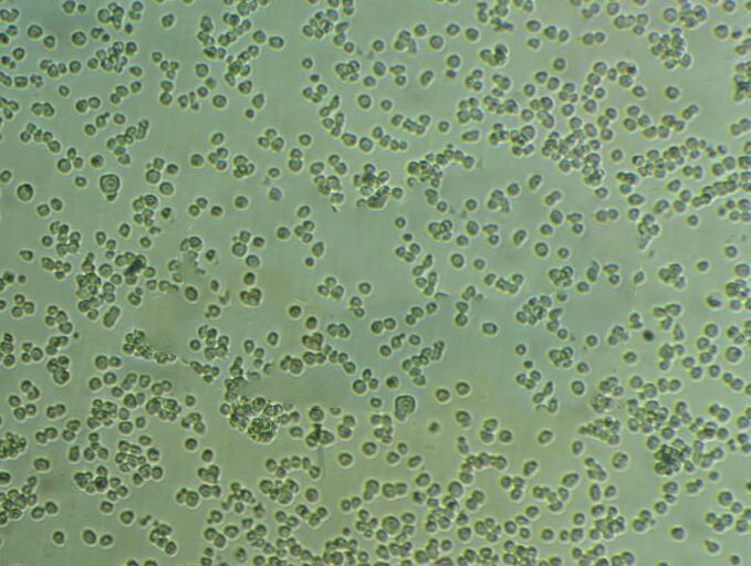 AC16 [Human hybrid cardiomyocyte] Cells人心肌細胞長期復(fù)蘇|帶STR圖譜,AC16 [Human hybrid cardiomyocyte] Cells