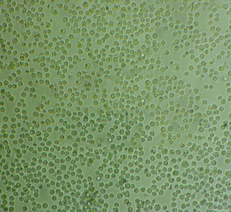 MDA-MB-231/GFP Cells人乳腺癌细胞长期复苏|带STR图谱,MDA-MB-231/GFP Cells