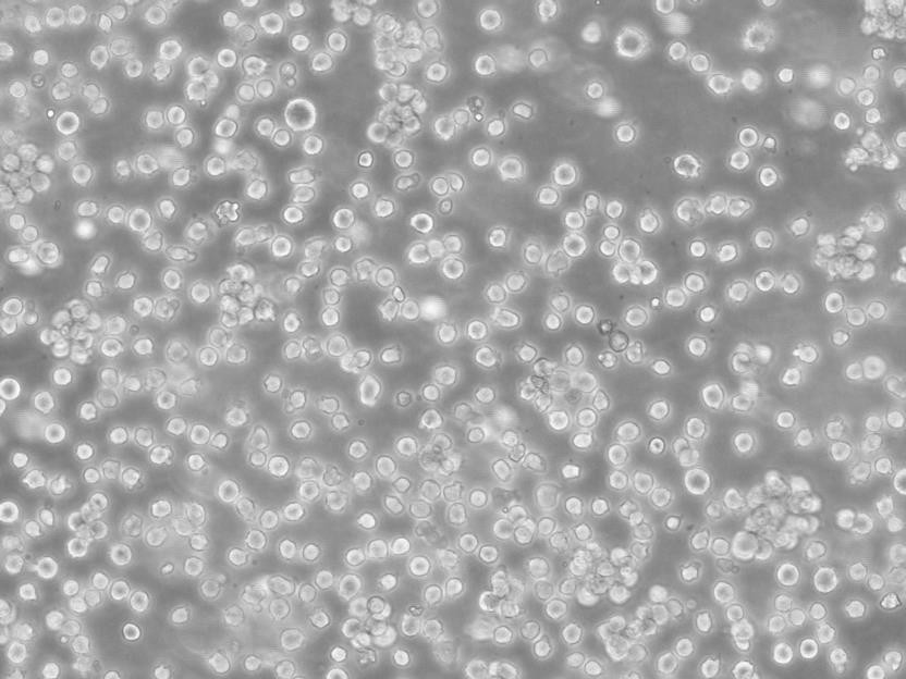 TE-10 Cells人食管癌細胞長期復蘇|帶STR圖譜,TE-10 Cells
