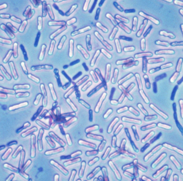 Mortierella Macrocystis,Mortierella Macrocystis