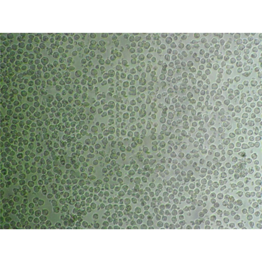 C-33 A Cells人子宮頸癌細胞庫專業(yè)復蘇|有STR圖譜,C-33 A Cells