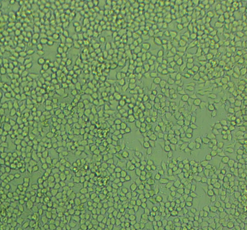 OVCAR-3-GFP Cells人卵巢癌腺癌細(xì)胞長期復(fù)蘇|帶STR圖譜,OVCAR-3-GFP Cells