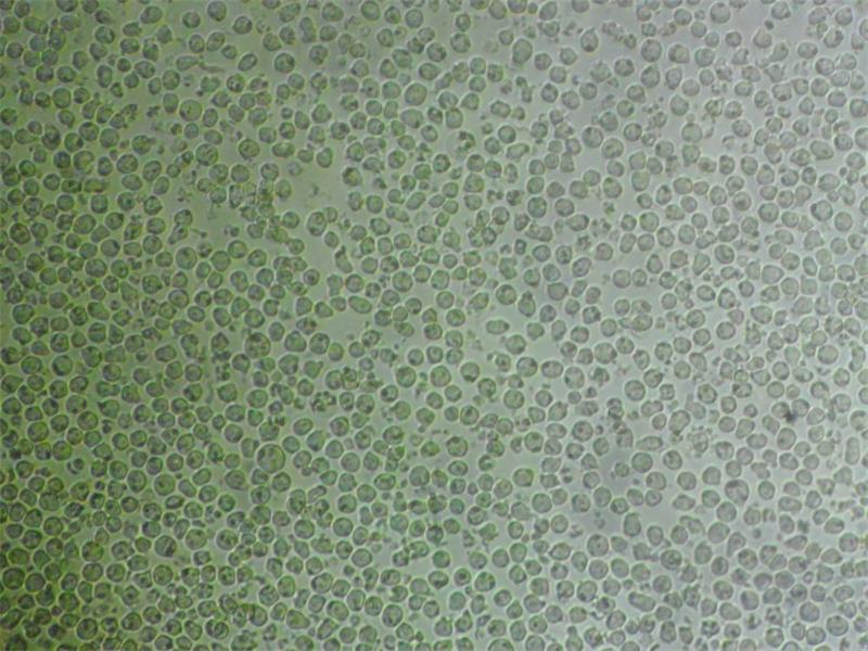HCT116-EGFP Cells人细胞|仅提供STR图谱,HCT116-EGFP Cells
