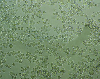 HCT 116 EP300(-) clone F5 Cells人細(xì)胞|僅提供STR圖譜,HCT 116 EP300(-) clone F5 Cells