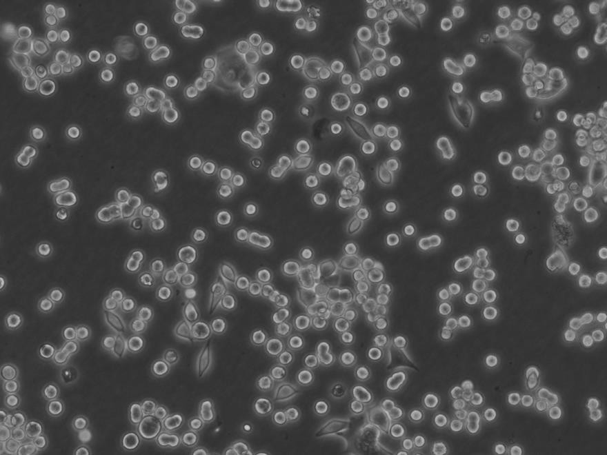 KYSE-520 Cells人食管鱗癌細(xì)胞復(fù)蘇培養(yǎng)|有STR圖譜,KYSE-520 Cells