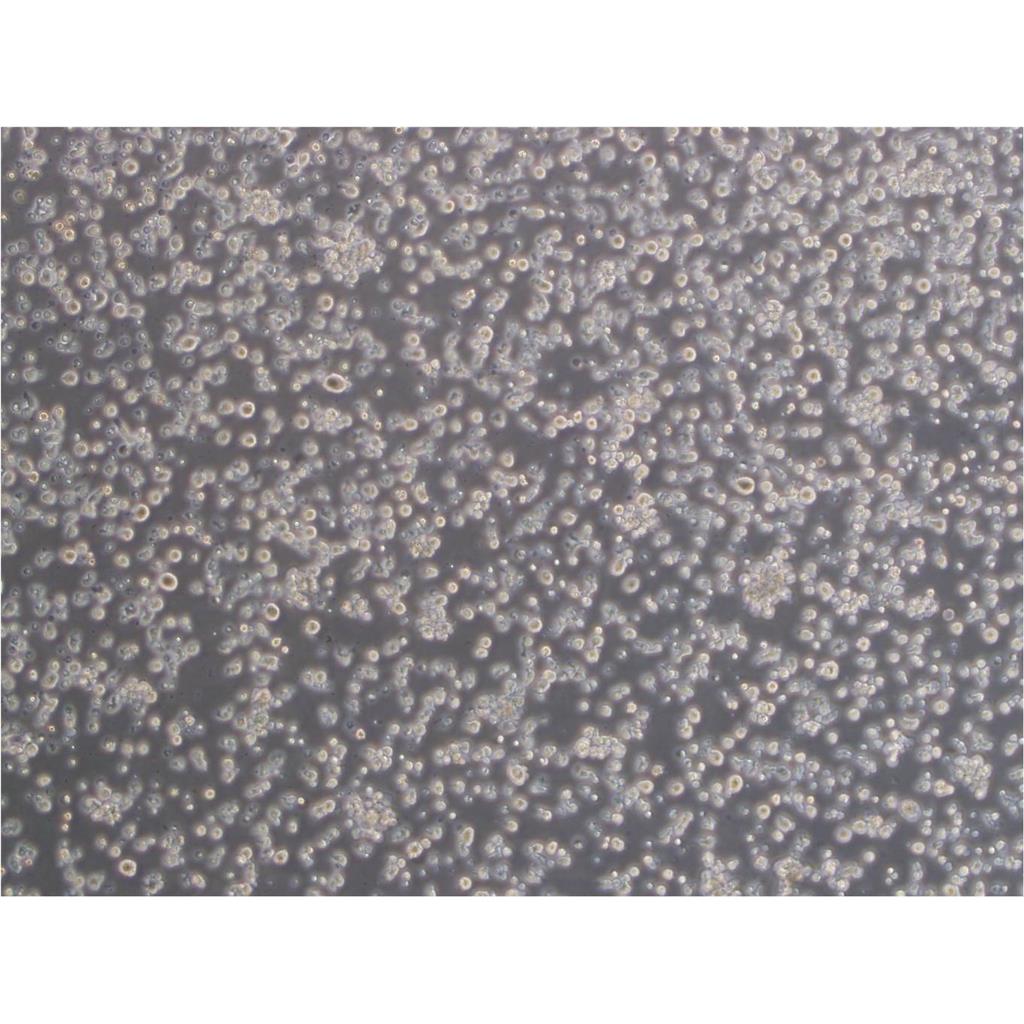 HS-683 Cell人腦膠質(zhì)瘤貼壁細(xì)胞,HS-683 Cell