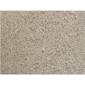 LaNCE hiPSC-21 Cells人细胞|仅提供STR图谱