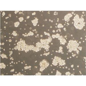 HCT 116 BRCA2(-/-) clone 42 Cells人細(xì)胞|僅提供STR圖譜,HCT 116 BRCA2(-/-) clone 42 Cells
