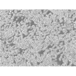 KYSE-180 Cells人食管鱗癌細胞復蘇培養(yǎng)|有STR圖譜,KYSE-180 Cells