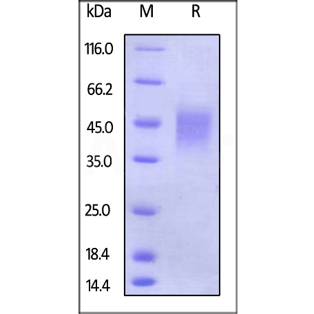 Human Fc gamma RIIIB / CD16b (NA2) Protein, His Tag (百普賽斯 CDB-H5222)