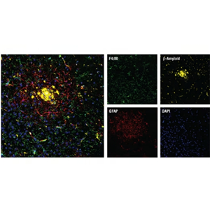 F4/80 (D4C8V) XP Rabbit mAb(CST 30325)