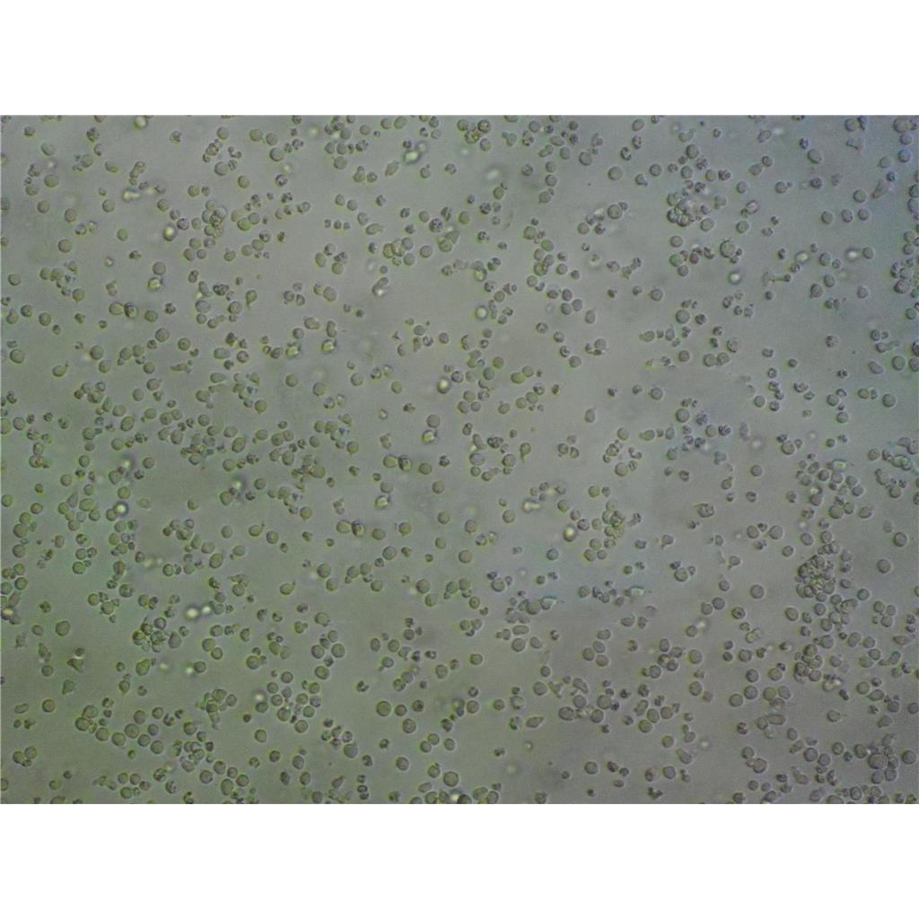 CX16-RV7 Endo Cells人细胞|仅提供STR图谱,CX16-RV7 Endo Cells