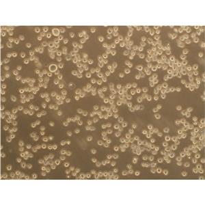 LaNCE hiPSC-47 Cells人细胞|仅提供STR图谱