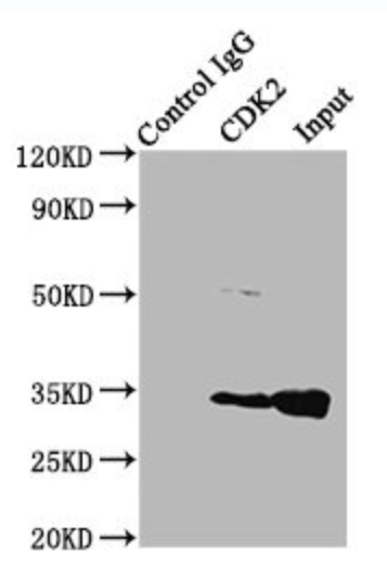 細(xì)胞周期蛋白依賴性激酶2/細(xì)胞周期蛋白E1復(fù)合物（CDK2/CycE1）,CDK2/CycE1