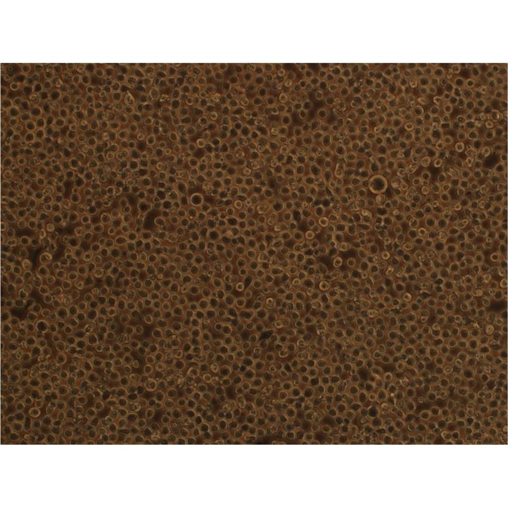 SW1710 Cells#人膀胱癌細胞系保種中心(通過STR鑒定),SW1710 Cells#