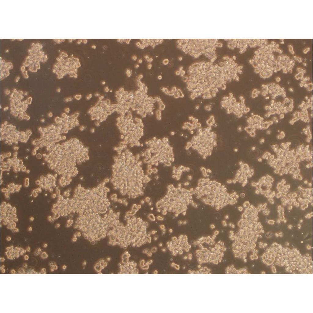 JHH-7 Cells#人肝癌細(xì)胞系保種中心(通過(guò)STR鑒定),JHH-7 Cells#