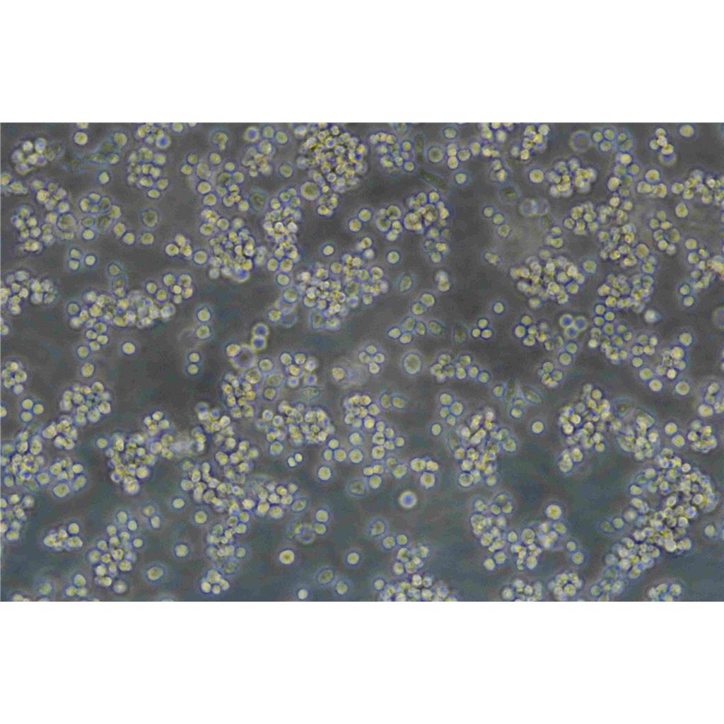 NCI H716 Cells人結(jié)直腸腺癌可傳代細胞系(送STR鑒定圖譜),NCI H716 Cells