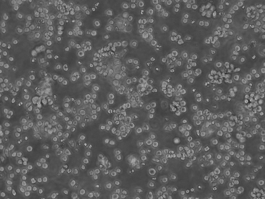 SW780 Cells人膀胱移行癌可傳代細(xì)胞系(送STR鑒定圖譜),SW780 Cells