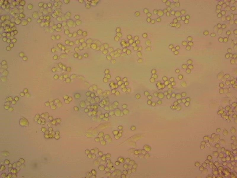 PaTu 8988t Cells#人胰腺癌细胞系保种中心(通过STR鉴定),PaTu 8988t Cells#