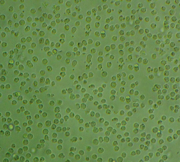 TM3 Cells:小鼠睪丸間質(zhì)細(xì)胞系代次低(帶STR鑒定報(bào)告),TM3 Cells: