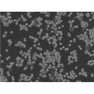 DLD-1 Cells#人結直腸腺癌上皮細胞系保種中心(通過STR鑒定),DLD-1 Cells#