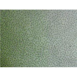 Caki-1 Cells#人腎透明細(xì)胞癌皮膚轉(zhuǎn)移細(xì)胞系保種中心(通過STR鑒定)