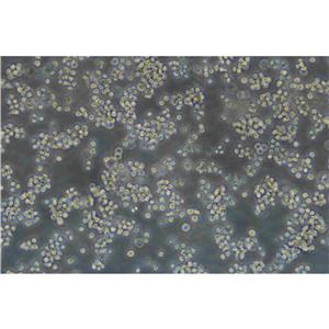 NCI-H660 Cells:人神經(jīng)內(nèi)分泌前列腺癌細胞系代次低(帶STR鑒定報告)