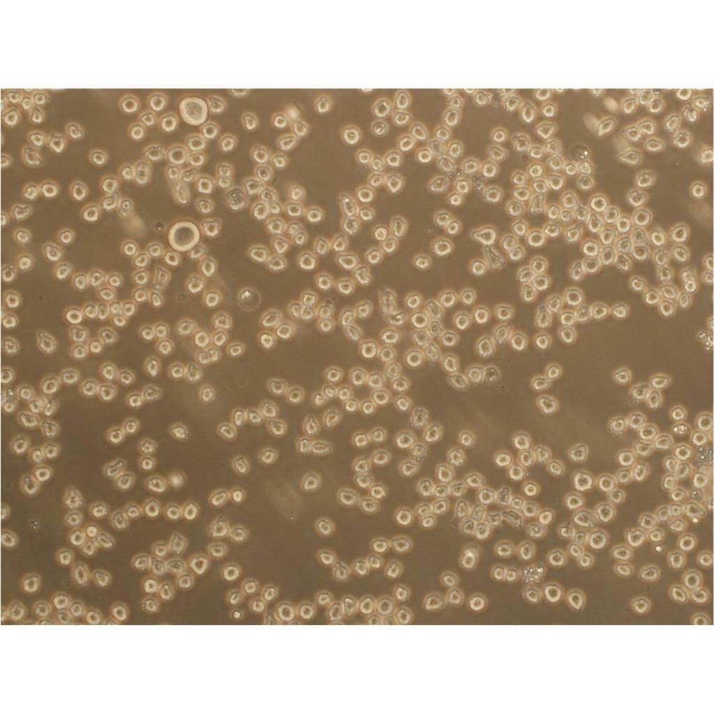 HS-5 Cells:人骨髓基质细胞系代次低(带STR鉴定报告),HS-5 Cells: