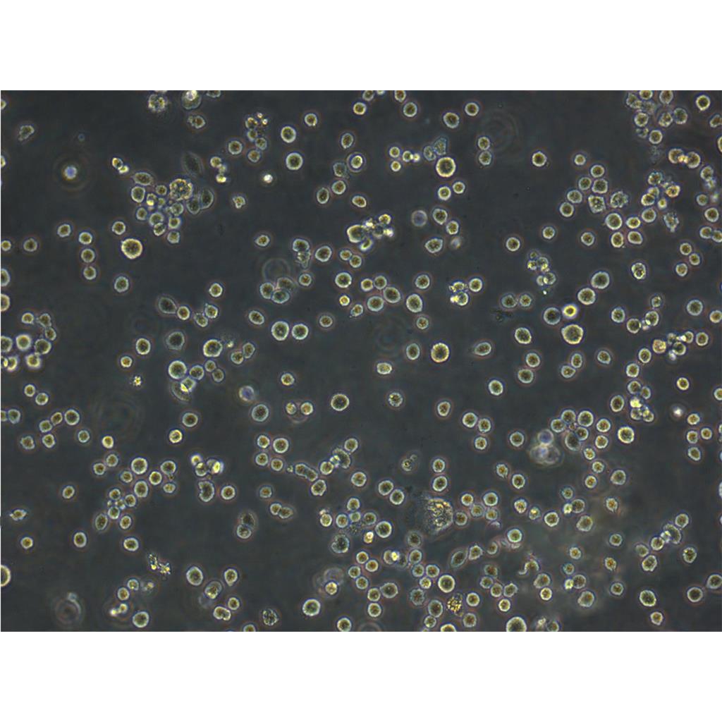 T2 Cells:人淋巴母細(xì)胞系代次低(帶STR鑒定報(bào)告),T2 Cells: