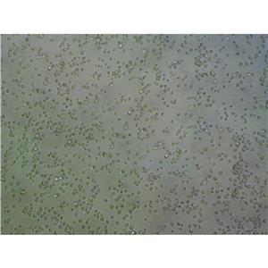 Ishikawa Cells:人子宮內(nèi)膜癌細(xì)胞系代次低(帶STR鑒定報告),Ishikawa Cells: