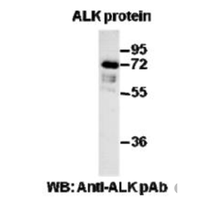 Anti Ras(G13D) Mouse Monoclonal Antibody