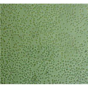 A172 Cells:人膠質(zhì)母細(xì)胞瘤細(xì)胞系代次低(帶STR鑒定報(bào)告)