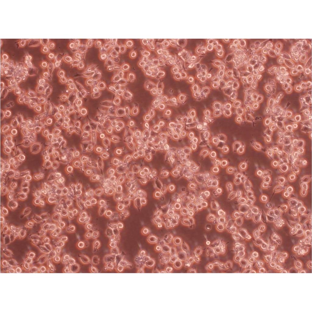 Panc 03.27 Cells人胰腺癌貼壁細(xì)胞系(提供所有細(xì)胞STR鑒定圖譜),Panc 03.27 Cell