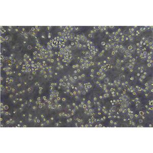 HCC1588 Cells人肺鱗癌貼壁細胞系(提供所有細胞STR鑒定圖譜)