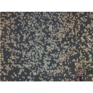 MDA-MB-175VII Cells人乳腺导管癌贴壁细胞系(提供所有细胞STR鉴定图谱)
