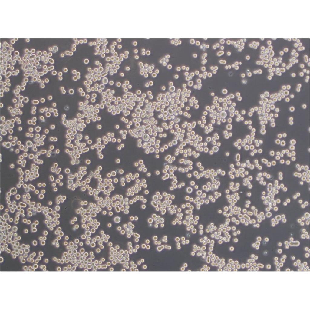 NCI-H460[H460] Cells人大细胞肺癌贴壁细胞系(提供所有细胞STR鉴定图谱),NCI-H460[H460] Cells