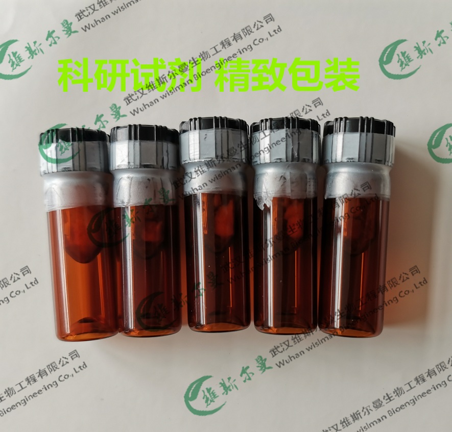 酸性磷酸酶,Phosphatase, Acid