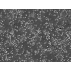A-253 Cells人頜下腺表皮癌復(fù)蘇細(xì)胞系|STR圖譜