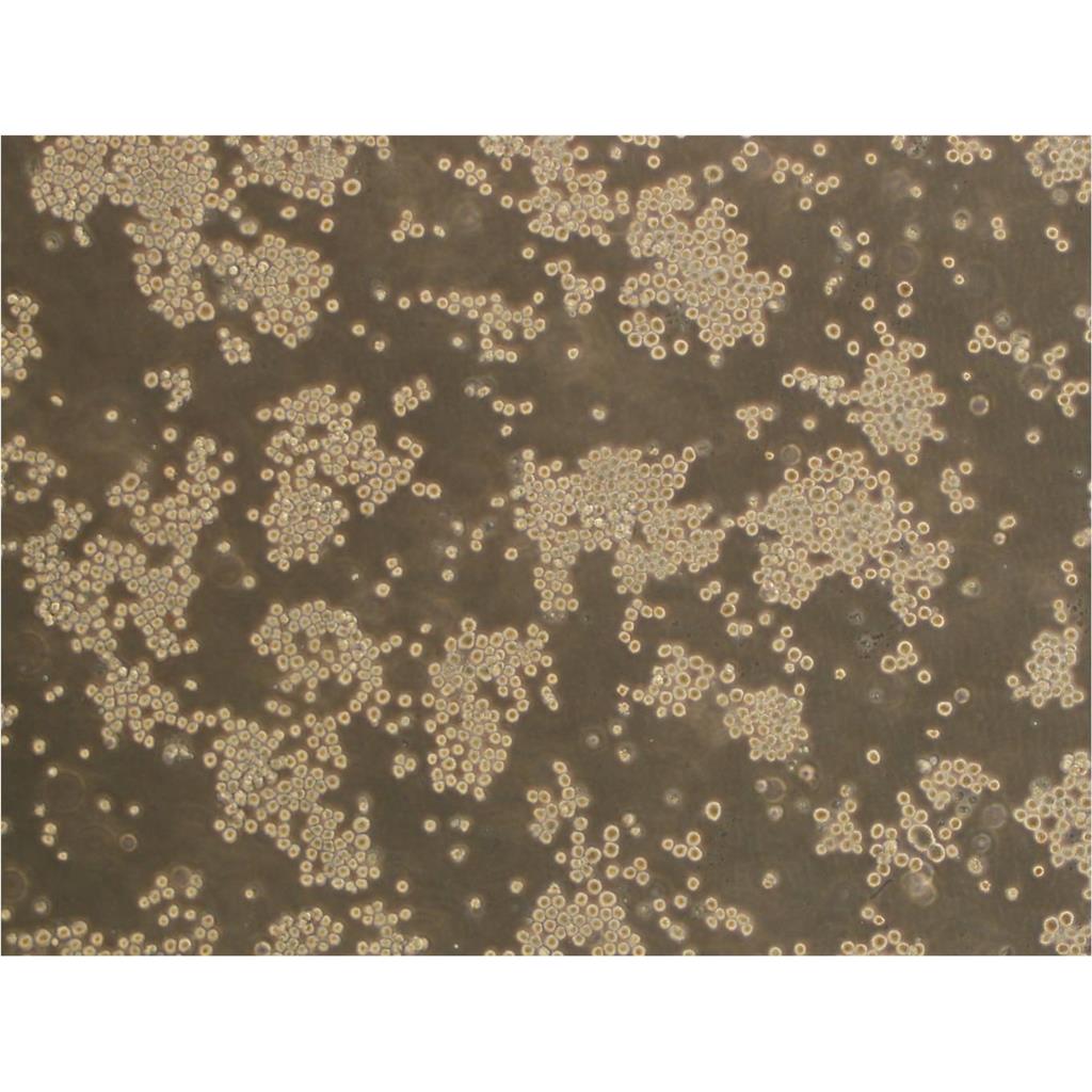 HBE135-E6E7 Cells人支氣管上皮復(fù)蘇細(xì)胞系|STR圖譜,HBE135-E6E7 Cells