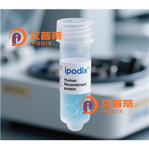PKD2抗体