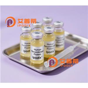 PRKAA1抗体,Mouse Monoclonal PRKAA1 Antibody