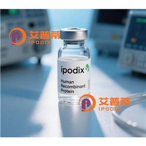 UBE2C抗体,Mouse Monoclonal UBE2C Antibody