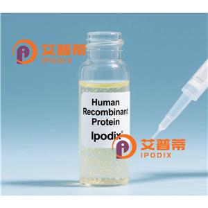 UCP2抗体,Mouse Monoclonal UCP2 Antibody