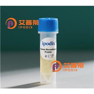 AP2M1抗體,Mouse Monoclonal AP2M1 Antibody