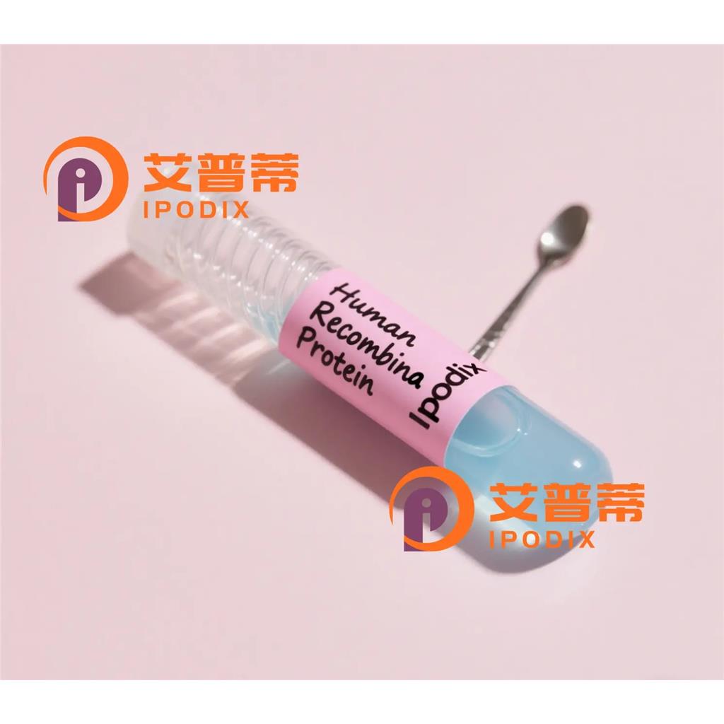 LGALS8抗体,Rabbit Polyclonal LGALS8 Antibody