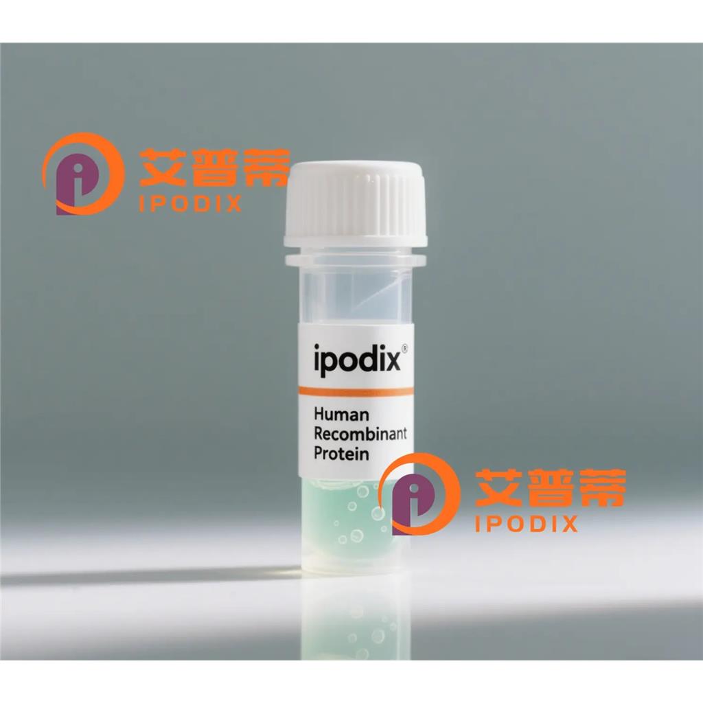 RNH1抗体,Rabbit Polyclonal RNH1 Antibody