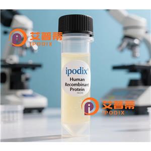 LGALS8抗体,Rabbit Polyclonal LGALS8 Antibody
