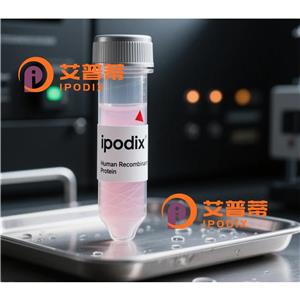 DLD抗体,Rabbit Polyclonal DLD Antibody