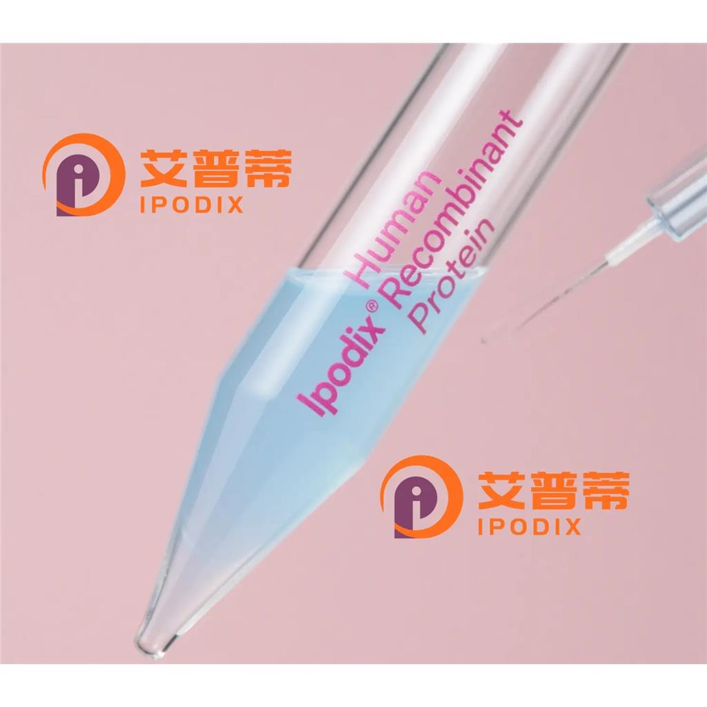 TACC2抗体,Rabbit Polyclonal TACC2 Antibody