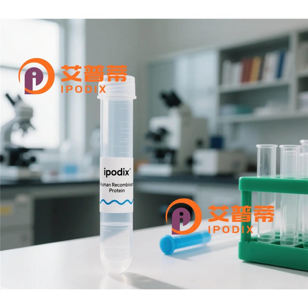 TBC1D21抗体,Rabbit Polyclonal TBC1D21 Antibody